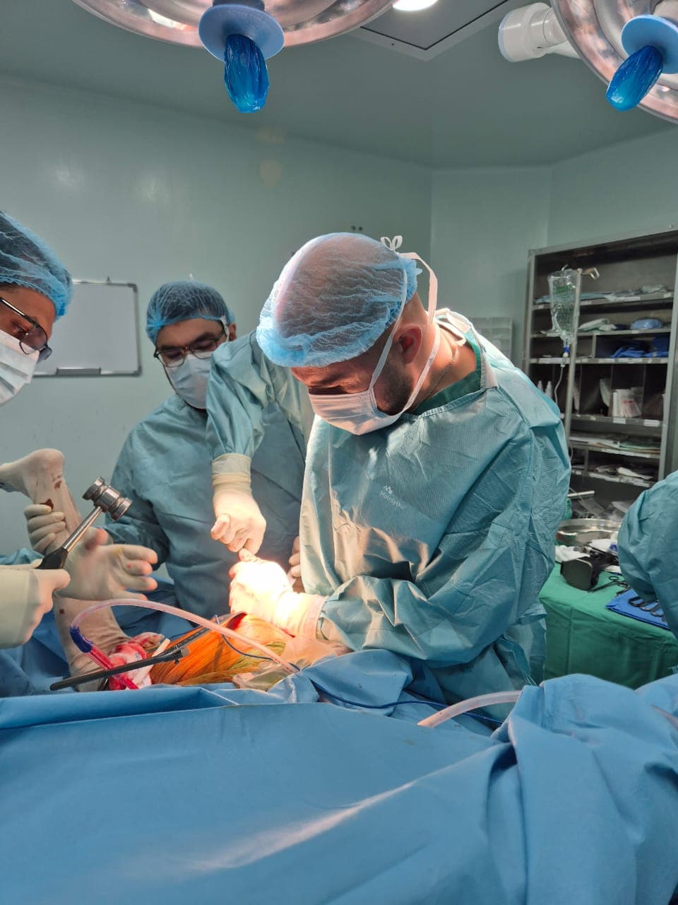 Arthroscopy
